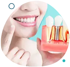 Implantologia dentale